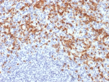MMP9 Antibody / Matrix metalloproteinase-9