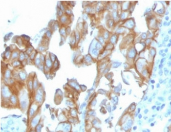 MerTK Antibody
