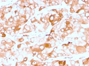 Prolactin Receptor Antibody / PRLR
