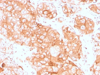 Prolactin Receptor Antibody / PRLR