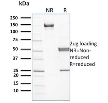 SPTB Antibody / Spectrin beta