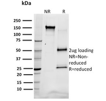 SREBP1 Antibody