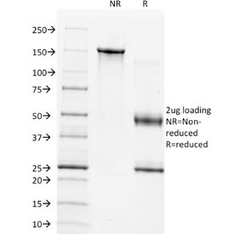 TIMP1 Antibody