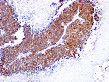 TOP1MT Antibody / Topoisomerase I mitochondrial