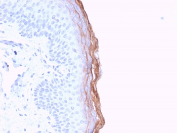 Kallikrein 5 Antibody / KLK5