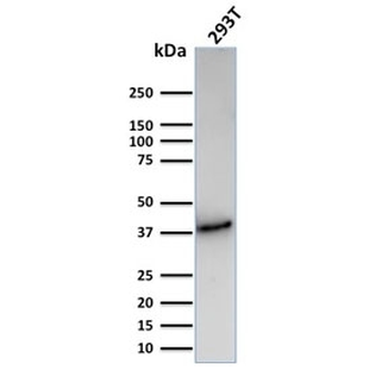 CD74 / CLIP Antibody