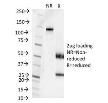 Pseudomonas aeruginosa serotype 6C Antibody