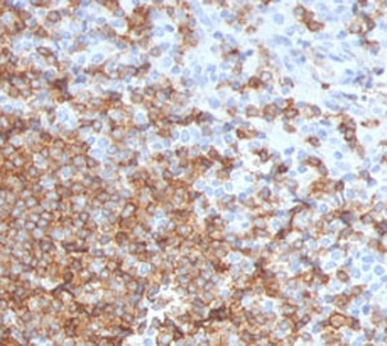 CD105 Antibody / Endoglin