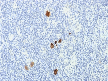 EBV Antibody / Epstein-Barr Virus