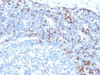 Integrin alpha E Antibody / CD103