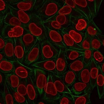 TIA-1 Antibody / T-Cell Intracellular Antigen-1