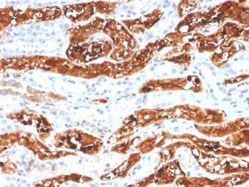 FGF21 Antibody / Fibroblast Growth Factor 21