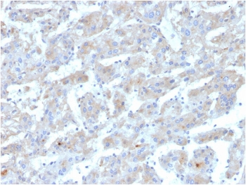 APOB Antibody / Apolipoprotein B