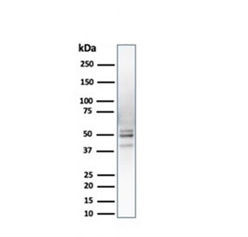 PSMD4 Antibody
