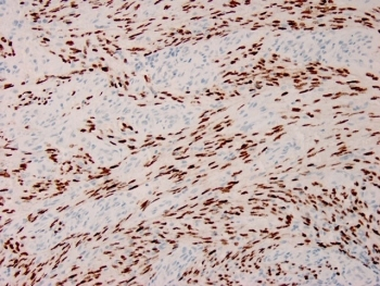 HHV8 Antibody / Human Herpes Virus 8