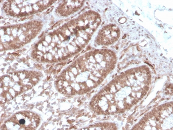 ACE Antibody / Angiotensin I Converting Enzyme
