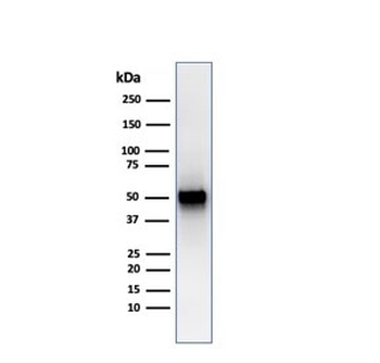 Thymidine Phosphorylase Antibody / PD-ECGF