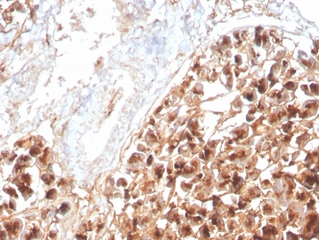 Eosinophil Peroxidase Antibody