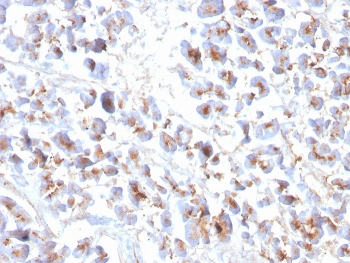 Eosinophil Peroxidase Antibody