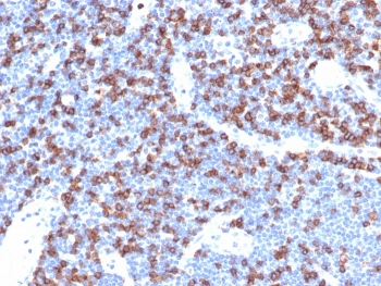 CD8A Antibody