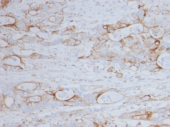 CD151 Antibody