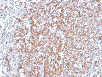 Cystatin A Antibody / CSTA