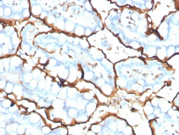 ACE Antibody / Angiotensin I Converting Enzyme