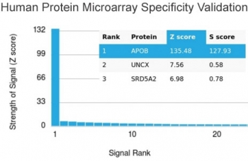 APOB Antibody / Apolipoprotein B
