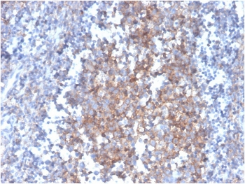 FasL Antibody / Fas Ligand