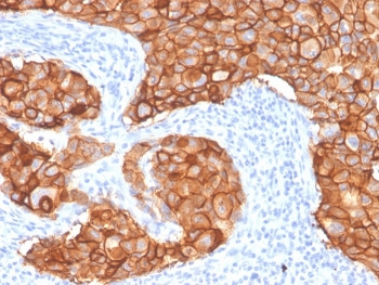 HER2 Antibody / ErbB2 / Extracellular region