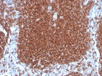 CD19 Antibody