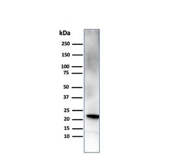 Retinol Binding Protein 4 Antibody / RBP4