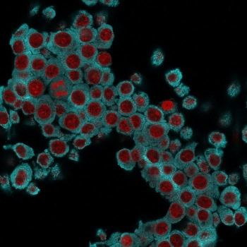 Keratin 6 Antibody / Cytokeratin 6