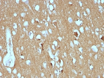 NCAM / CD56 Antibody