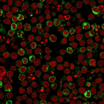 HLA-DRB1 Antibody (MHC II)