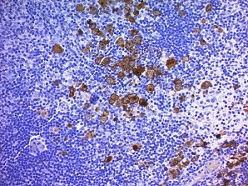 CD30 Antibody Cocktail