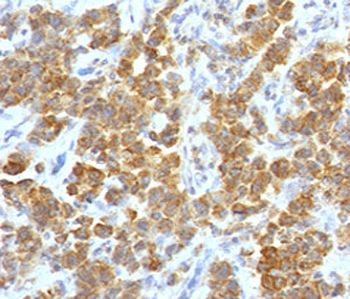 TNFSF15 Antibody / VEGI / TL1A