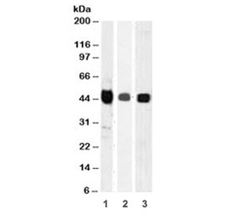 TIA-1 Antibody / T-Cell Intracellular Antigen-1