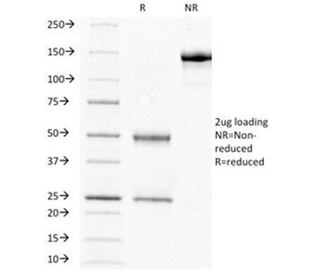 HCG-beta Antibody