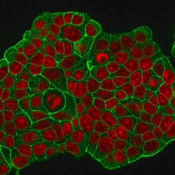 HER2 Antibody / ErbB2