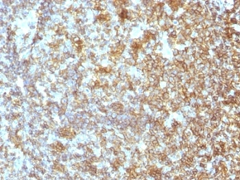 CD45 Antibody (Leukocyte marker)