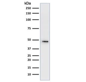 KRT19 Antibody Cocktail / Cytokeratin 19