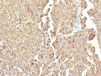 Chromogranin A Antibody Cocktail