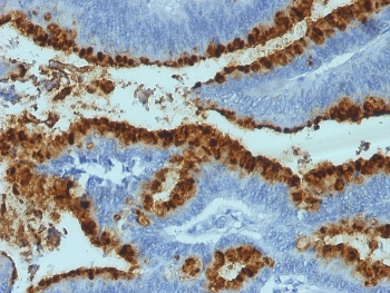 Blood Group Lewis b Antibody / FUT3