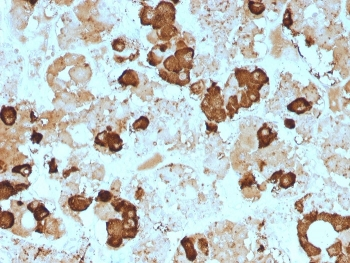 POMC Antibody / ACTH / N-Terminal