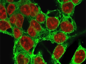 Glypican 3 Antibody / GPC3