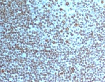 Nucleoli Marker Antibody