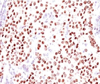 Progesterone Receptor Antibody