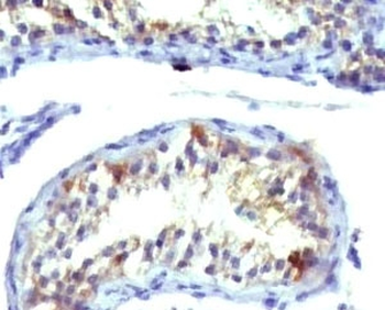 Prolactin Receptor Antibody / PRLR