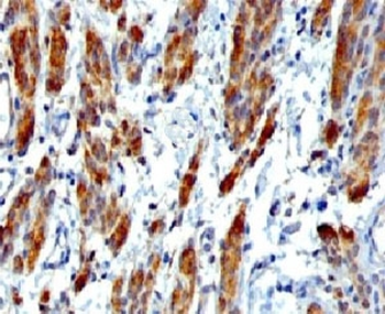 SMMHC Antibody (Smooth Muscle Myosin Heavy Chain)